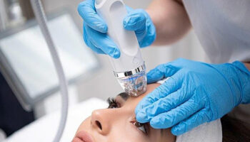 Transform Your Skin with RF Microneedling in Encino