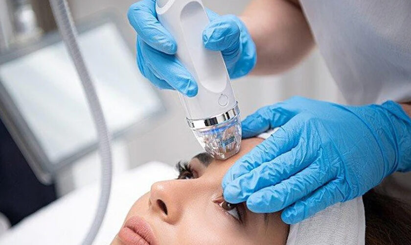 Transform Your Skin with RF Microneedling in Encino