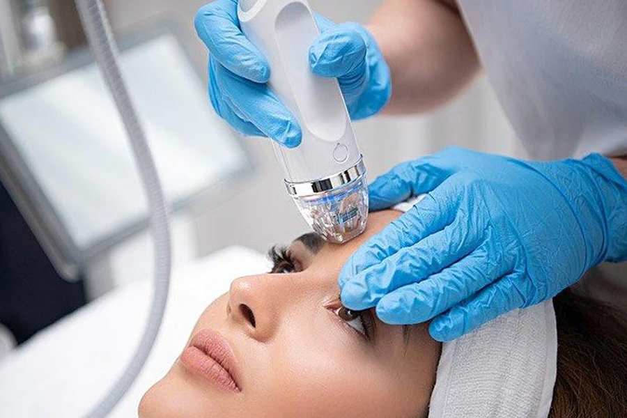 Transform Your Skin with RF Microneedling in Encino